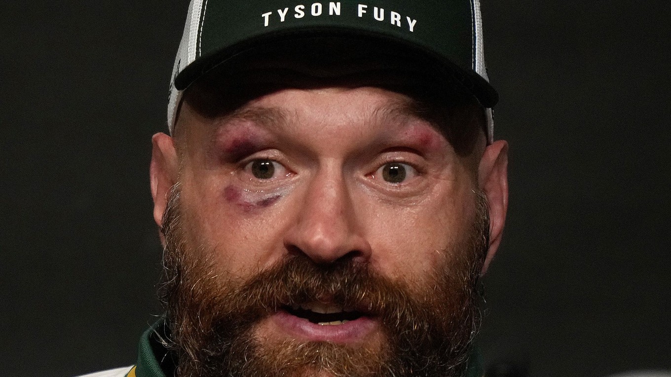 Britský boxer Tyson Fury.