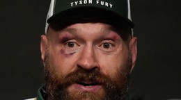 Britský boxer Tyson Fury.