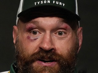 Britský boxer Tyson Fury.