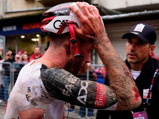 Britský cyklista Adam Yates po páde v 2. etape Giro d'Italia 2026.