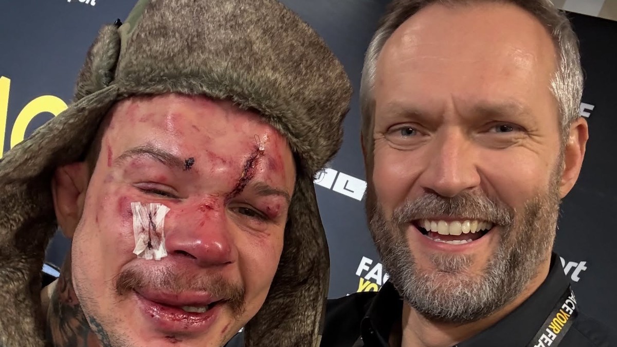 Budem ešte niekedy vyzerať normálne? Pukač zabával novinárov na tlačovke