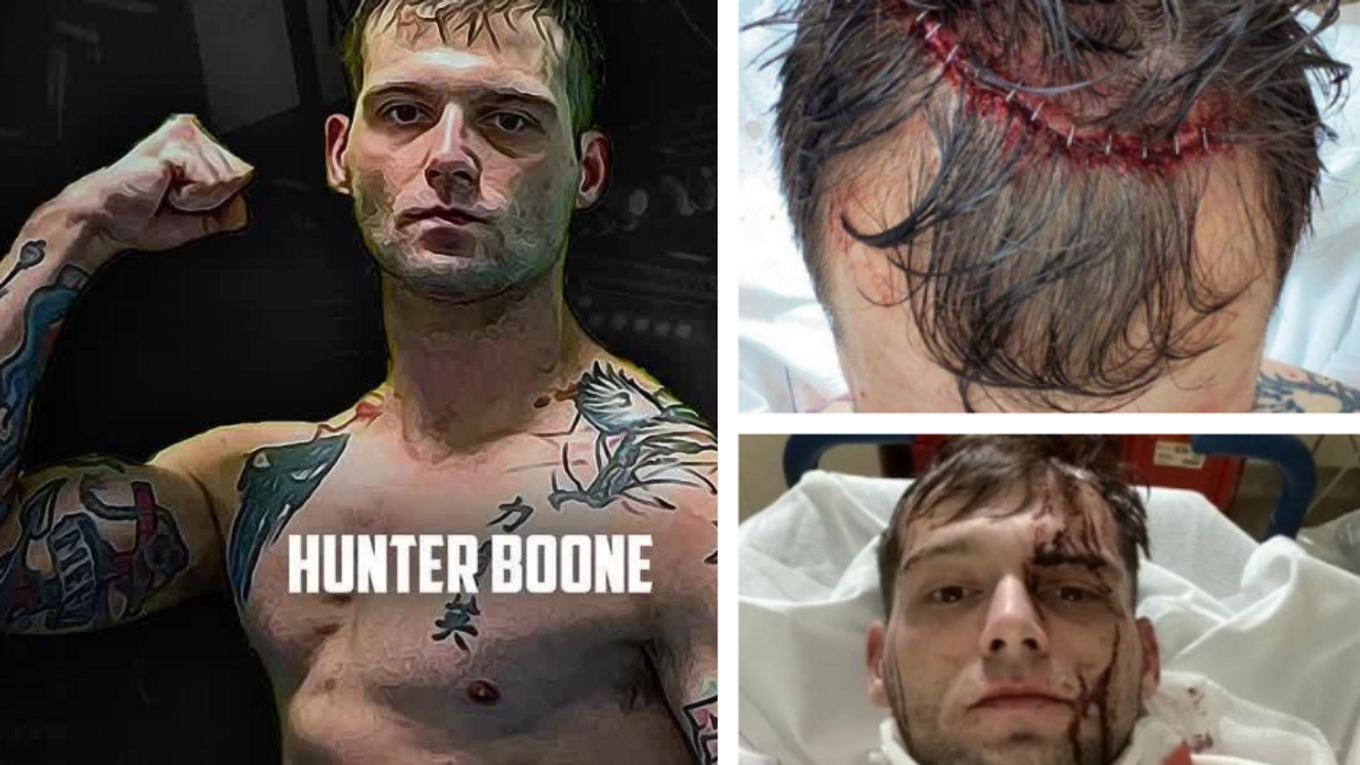 Hunter Boone sa nešťastne zranil.