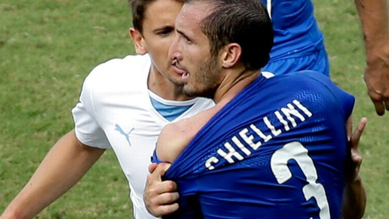 Obranca Chiellini ukazuje zranené rameno po zakusnutí od Suáreza.