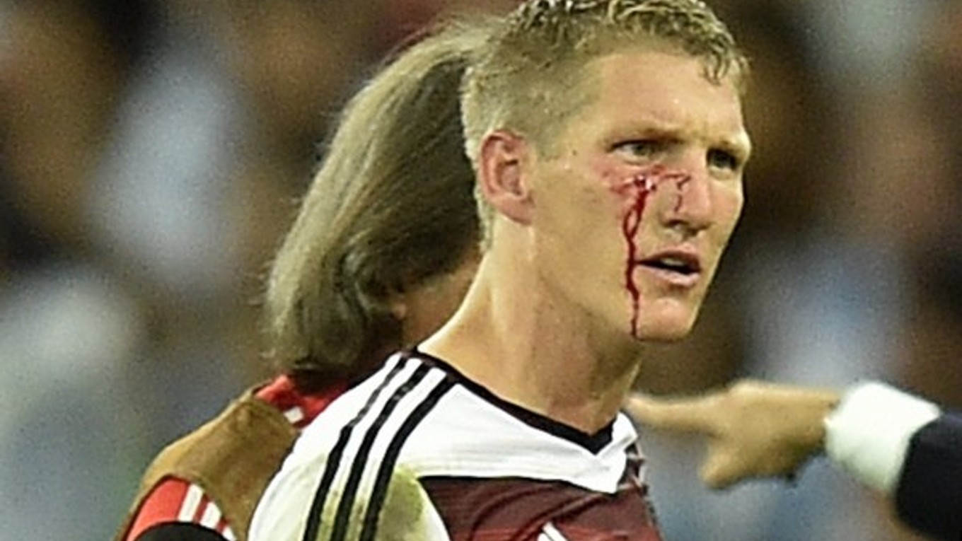 Zakrvavená tvár Bastiana Schweinsteigera.