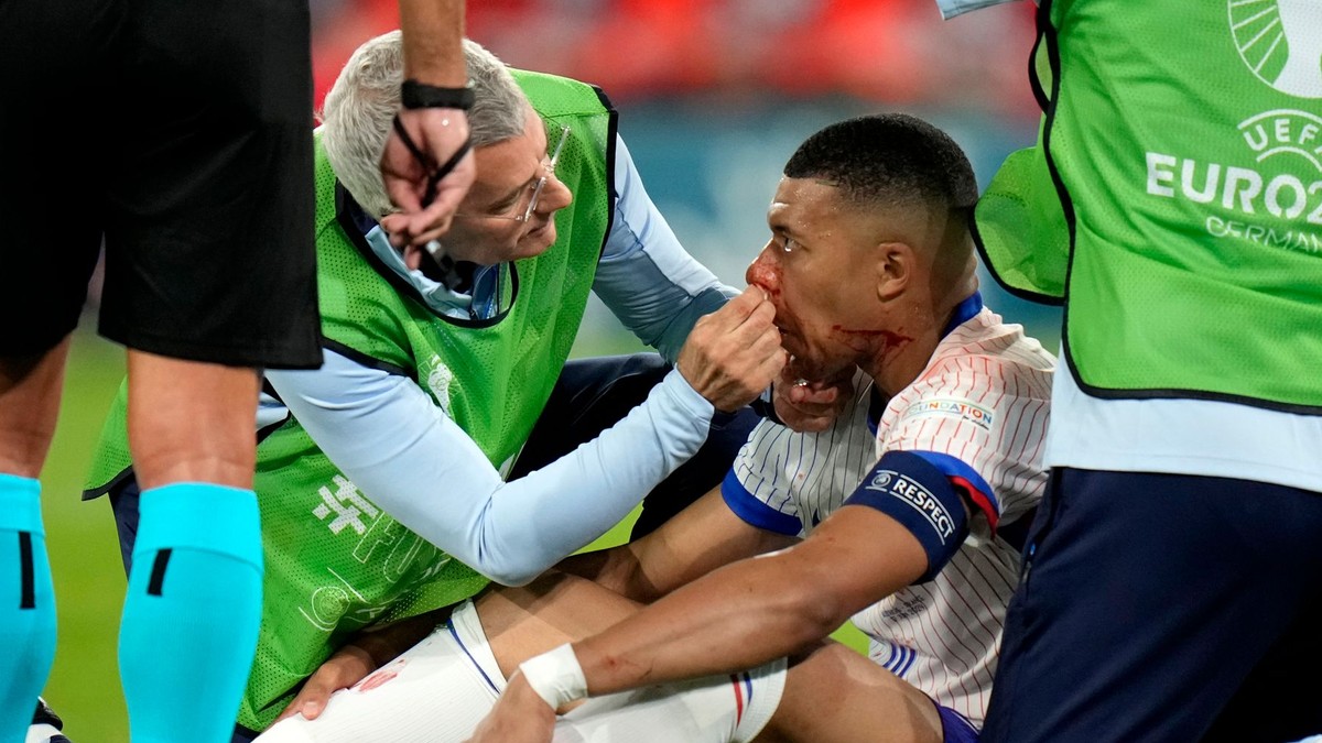 EURO 2024 : Complication pour la France, Kylian Mbappé s’est cassé le nez