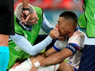 Kylian Mbappé si zlomil nos v zápase Francúzska s Rakúskom na EURO 2024