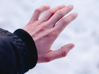 SFZ/LEKÁR RADÍ: Nenápadná chladová alergia