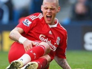 Martin Škrtel nedohral duel na City of Manchester Stadium. Podľa jeho slov väčšiu bolesť ešte nezažil.
