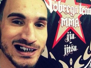 Portugalčan zomrel na následky zranení zo zápasu MMA