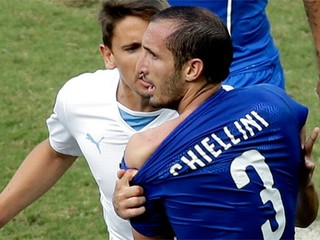Obranca Chiellini ukazuje zranené rameno po zakusnutí od Suáreza.