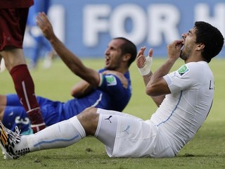 Luis Suárez tesne po incidente s Chiellinim.