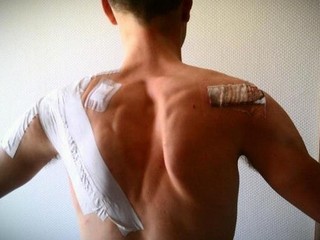 Ted King si pri páde v prvej etape vykĺbil rameno a utŕžil množstvo odrenín.