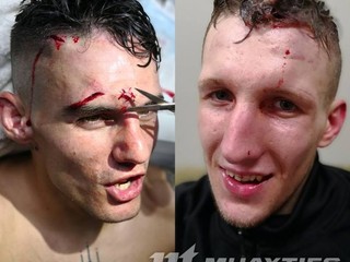 Jakub Benko v krvavom zápase v Austrálii - VIDEO