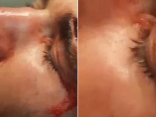 Podujatie Cage Warriors 93 prinieslo jeden z najhrozivejších cutov v dejinách MMA