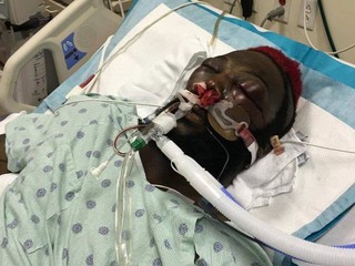 Výsledok zápasu Kimbo Slice vs. Dada 5000 bol dodatočne zmenený!