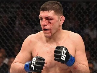 Nick Diaz oslobodený spod obžaloby za domáce násilie!