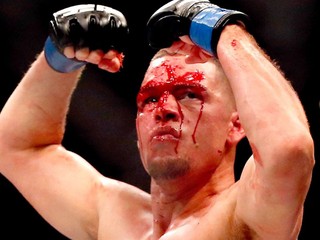 Nate Diaz: „Nakopem Floyda a Conora do zadku behom jednej noci!“