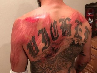 Bojovník UFC účastníkom nehody, skončil na pohotovosti