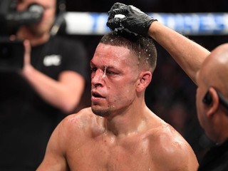Nate Diaz mal podozrivý dopingový nález, zápas s Masvidalom v ohrození