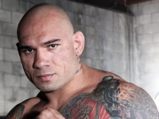 Dobré správy! Santos sa nemusí obávať účtov za operáciu prasknutej lebky