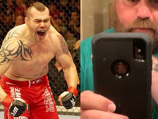 UFC nechce zaplatiť operáciu bývalému šampiónovi, jeho snúbenica zorganizovala zbierku