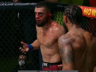 UFC Vegas 13: Bojovník takmer prišiel o ucho