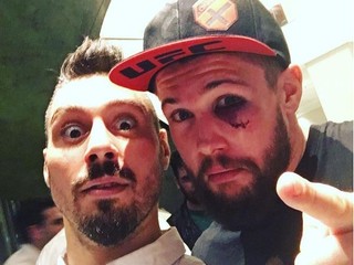 Nicolas Dalby utrpel v súboji s Petrom Sobottom zlomeninu očnice!