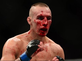 BREAKING: Rory MacDonald debutuje v máji v Bellatore!