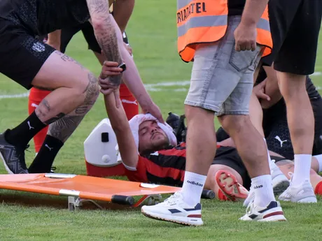 Milan Corryn (Trnava) so zranenou hlavou v zápase MFK Zemplín Michalovce - FC Spartak Trnava.