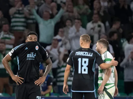 Zľava Cesar Blackman, Nino Marcelli a James Forrest v zápase Celtic Glasgow - ŠK Slovan Bratislava v 1. kole ligovej fázy Ligy majstrov.