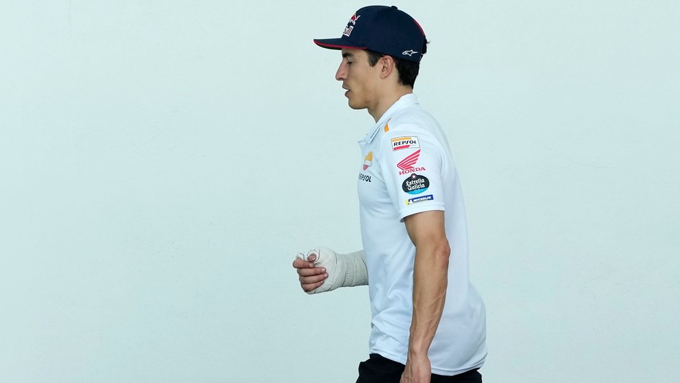 Pretekár MotoGP Marc Márquez po operácii zranenej ruky. 