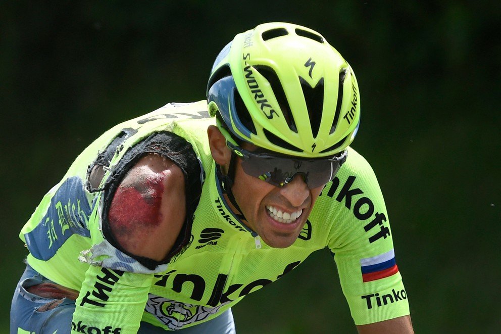 Albertovi Contadorovi tohtoročná Tour nepriala. Hneď v prvej etape utrpel nepríjemné zranenie. Potom spadol aj v druhej, neskôr dostal horúčku a v deviatej etape z pretekov odstúpil.