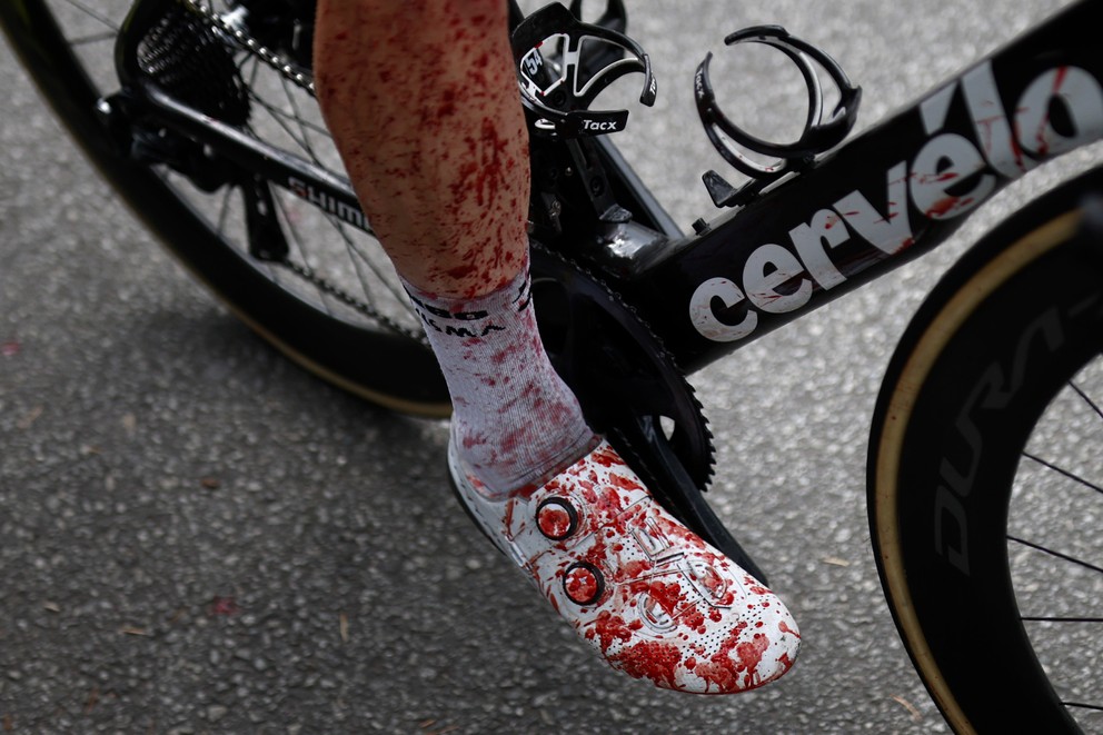 Steven Kruijswijk prišiel do cieľa s nohou postriekanou krvou.