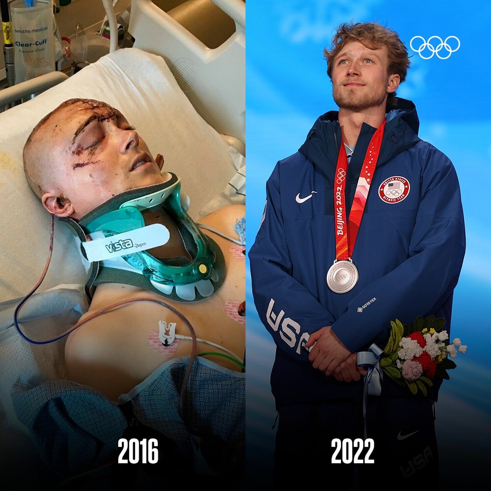 Colby Stevenson po nehode v roku 2016 a so striebornou medailou na ZOH 2022 v Pekingu.