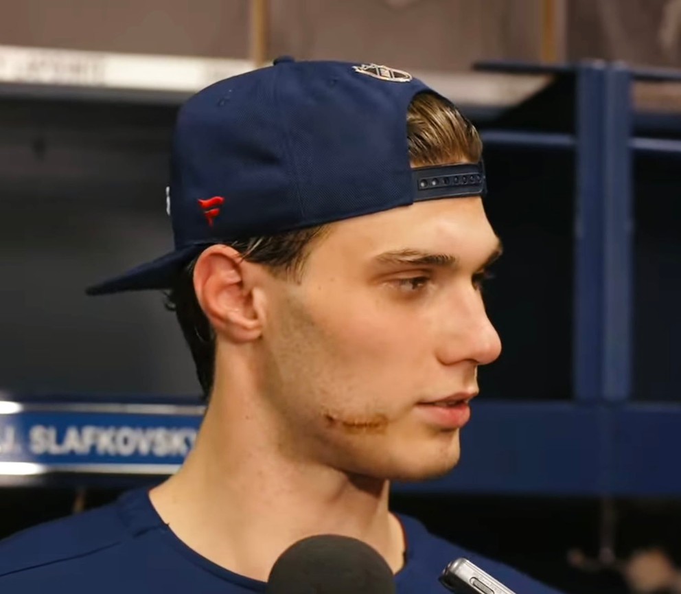 Juraj Slafkovský počas prípravy utrpel zranenie na tvári. 