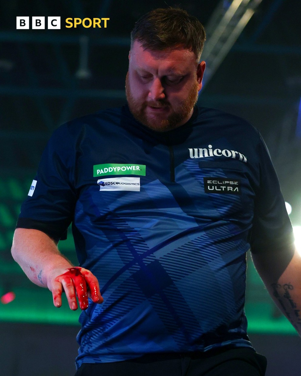 Škótsky šípkar Cameron Menzies s poranenou rukou po prehre v 1. kole MS 2026. 